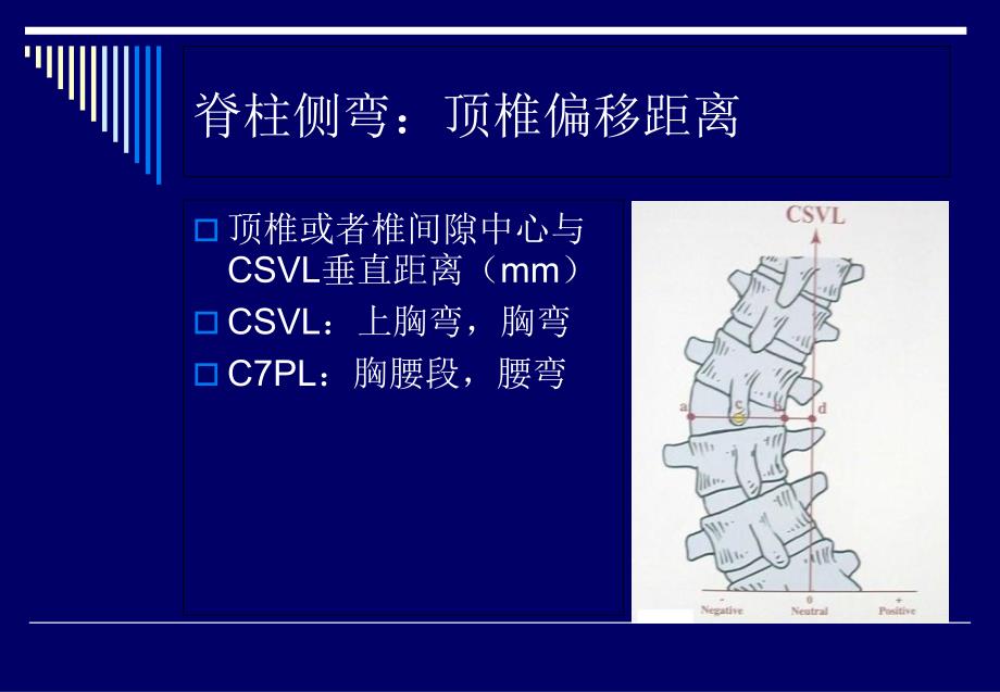 脊柱侧弯基础知识文档资料_第4页