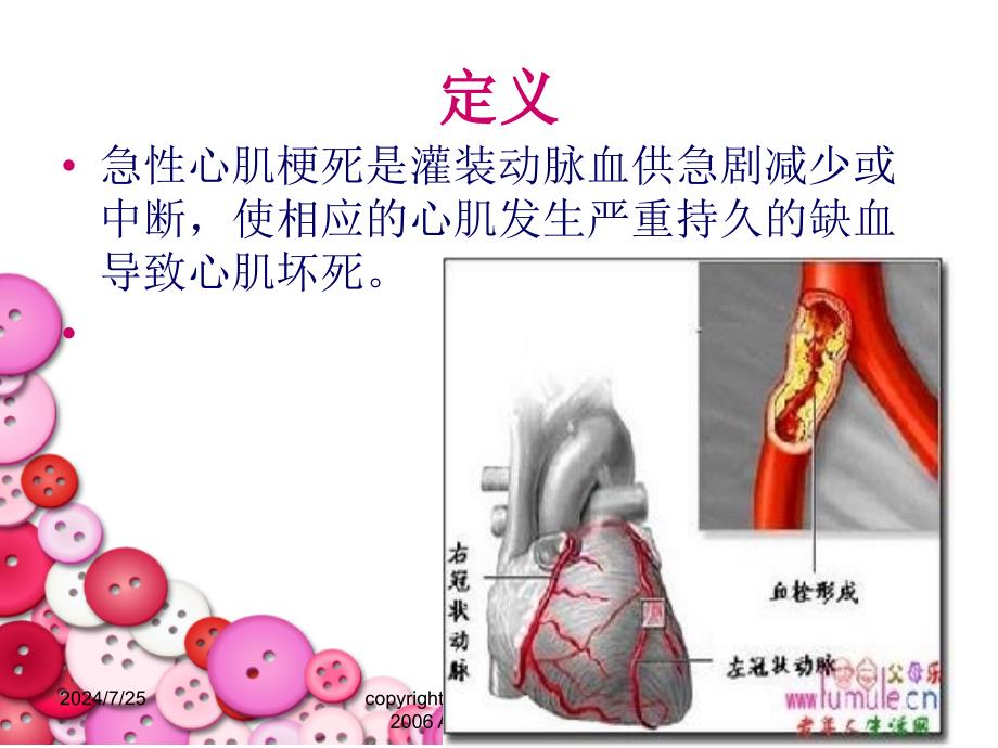 急性心肌梗死病人的护理文档资料_第3页