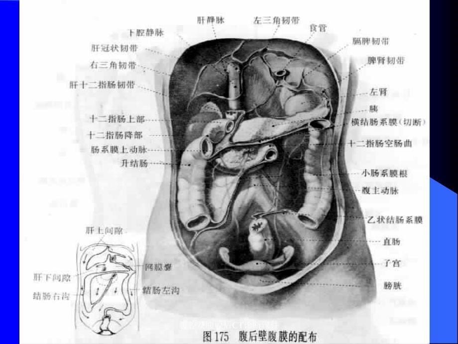 腹腔及腹膜后CT诊断课件_第5页