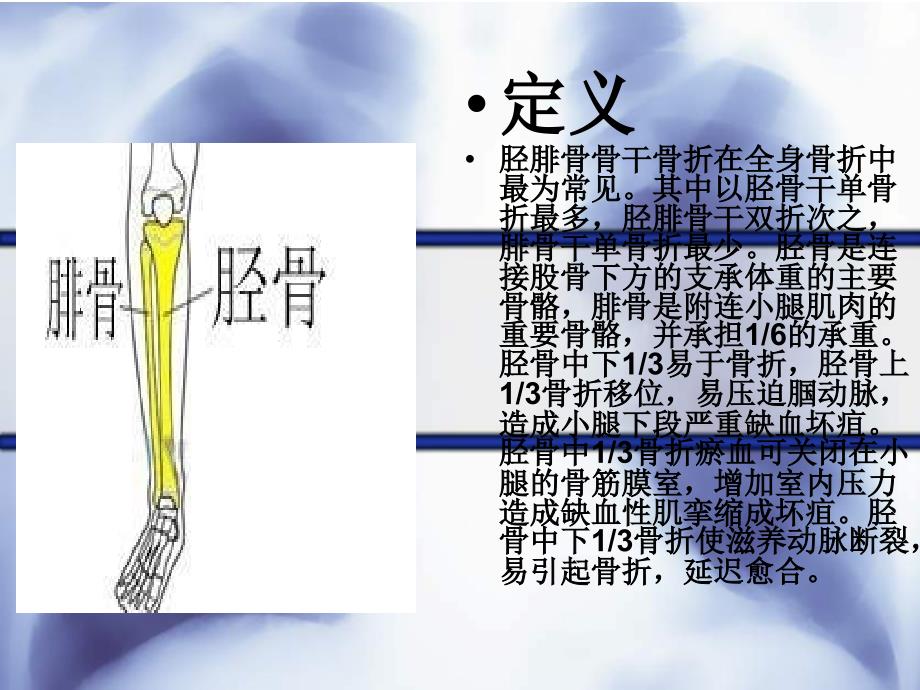 胫腓骨骨折围手术期的护理_第3页