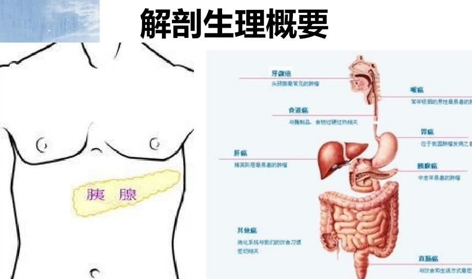 急性胰腺炎病人的护理.ppt_第3页