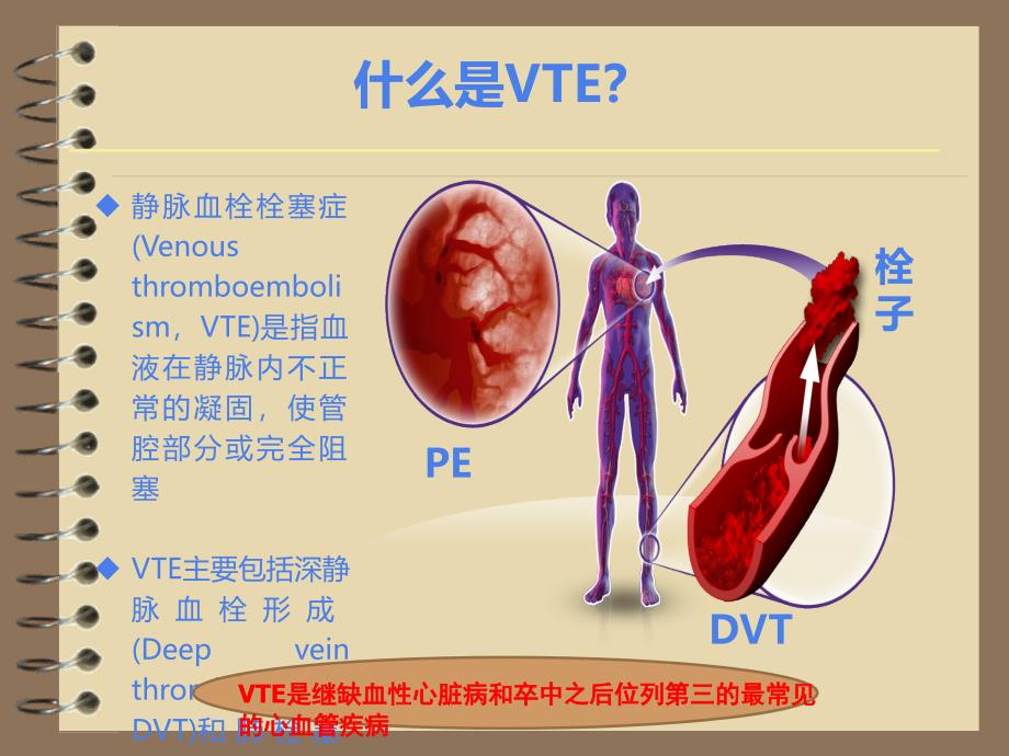 静脉血栓栓塞症(VTE)的诊断和治疗.ppt_第3页