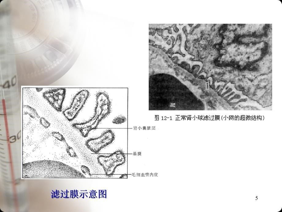 生化检验指标在慢性肾病早期诊断中的应用_第5页