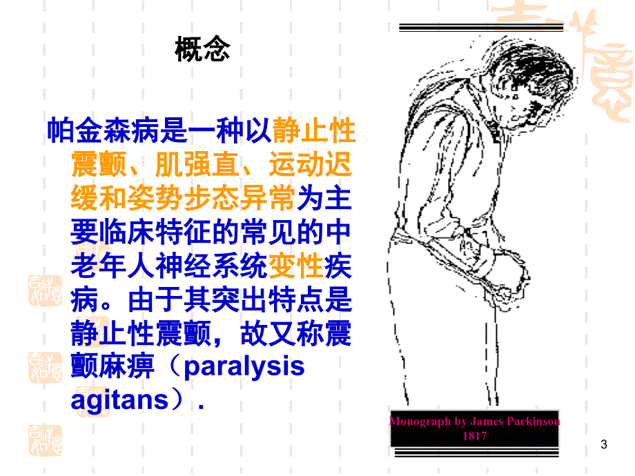 帕金森病的护理ppt参考课件_第3页