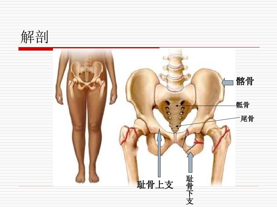 新骨盆骨折课件_第4页