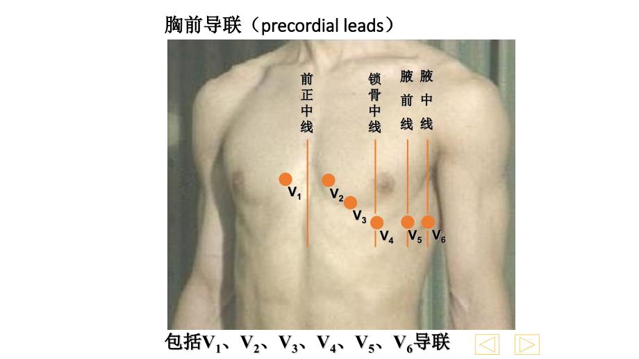 心电图操作及简单解读.ppt_第4页