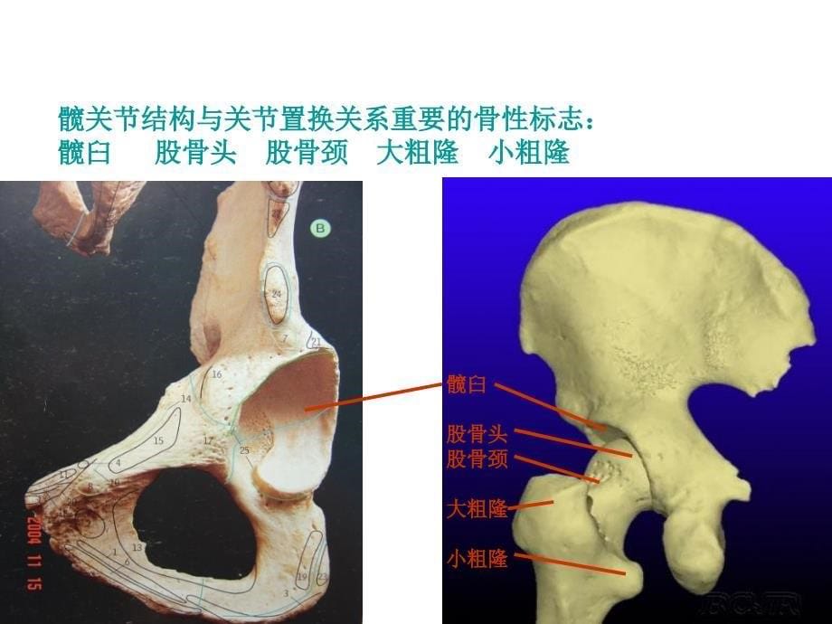 髋关节解剖解析_第5页