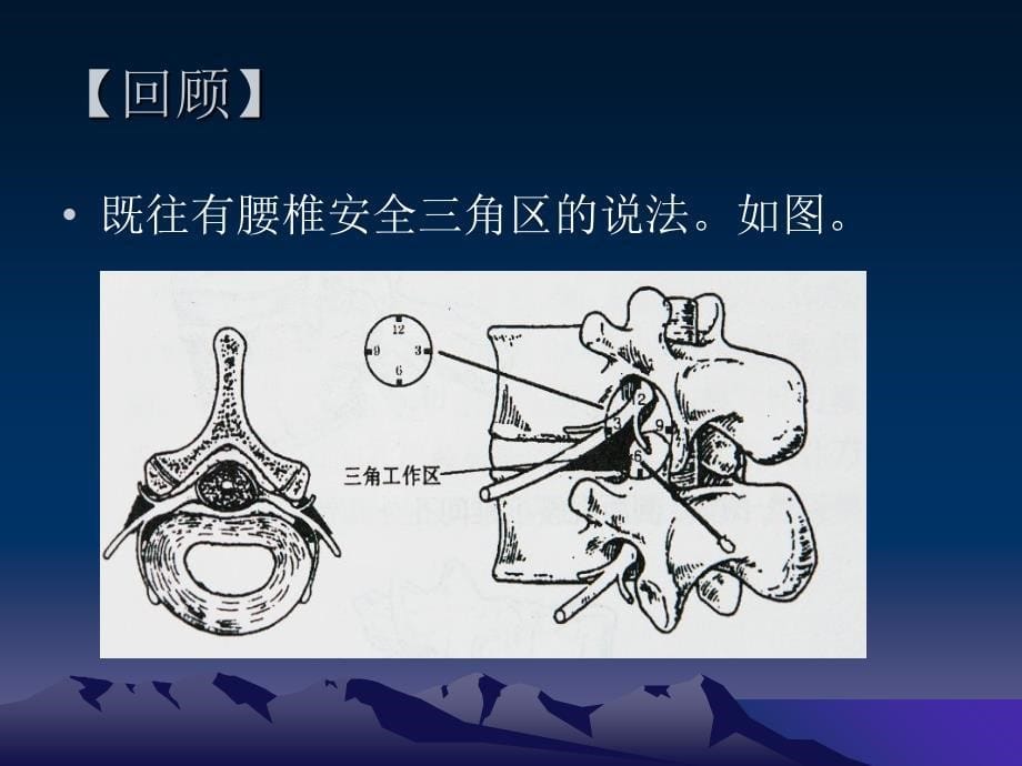 腰椎椎间孔外口的解剖学研究顾雪忠_第5页