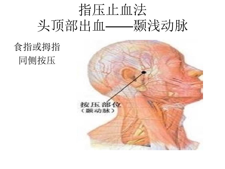 急救知识培训ppt课件_第4页