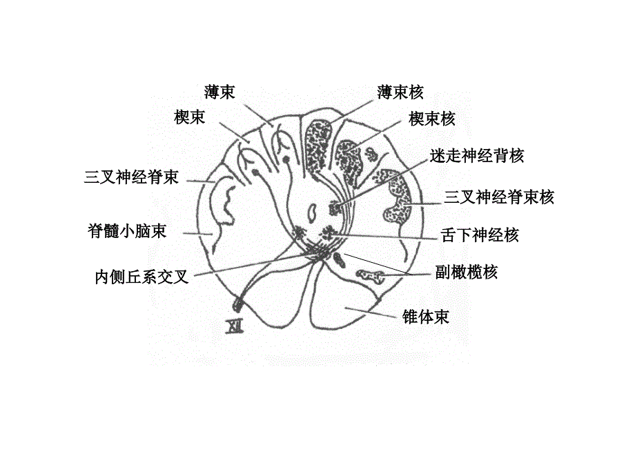 脑干断面图(作业)01_第3页