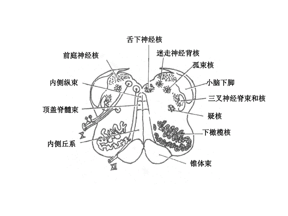 脑干断面图(作业)01_第4页