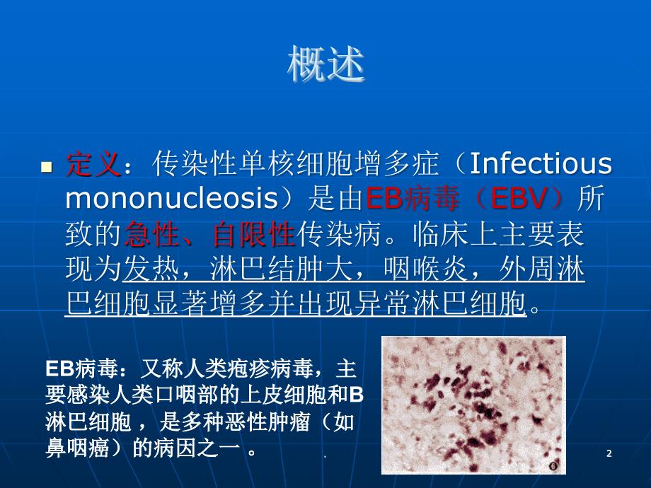 传染性单核细胞增护理查房ppt医学课件_第2页