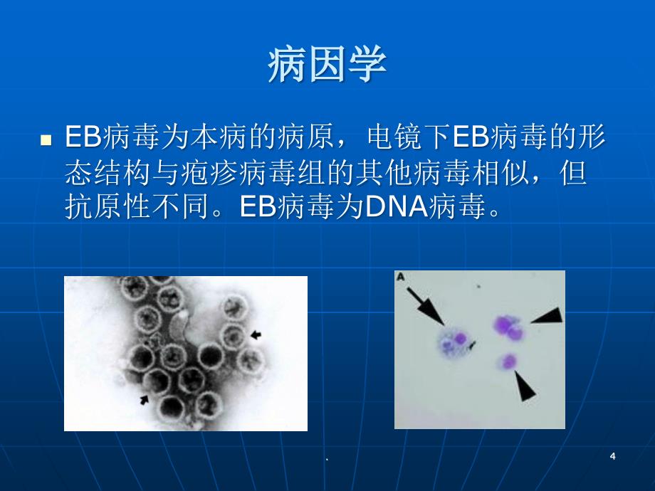 传染性单核细胞增护理查房ppt医学课件_第4页