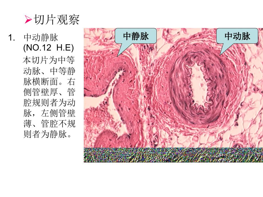 实验五循环系统、皮肤_第3页