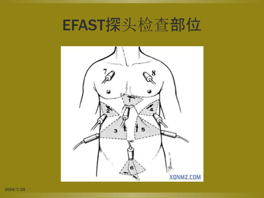 床旁超声FAST介入超声课件_第4页