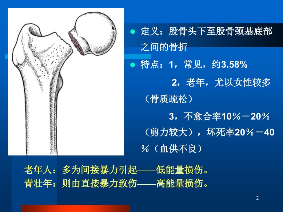 股骨颈骨折课件_第2页