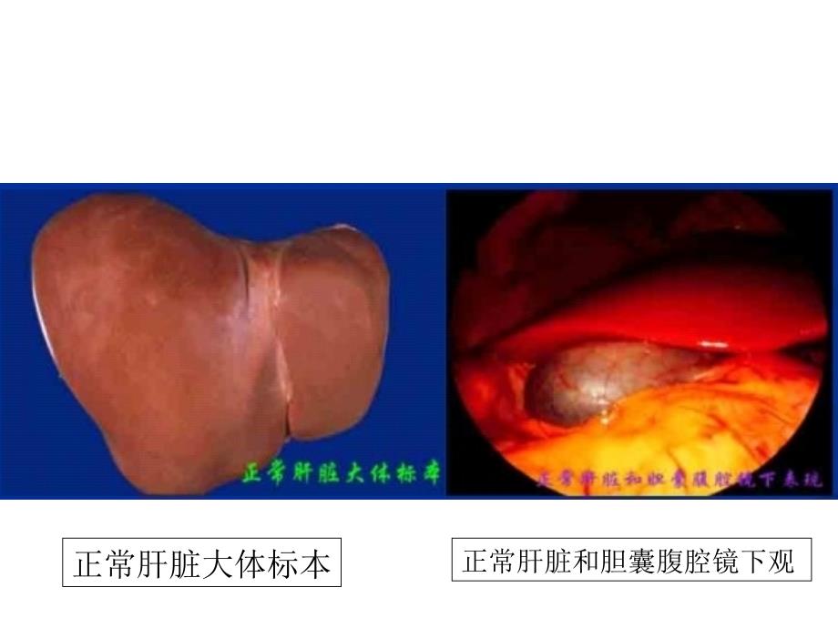 病理生理学课件：肝功能不全_第3页