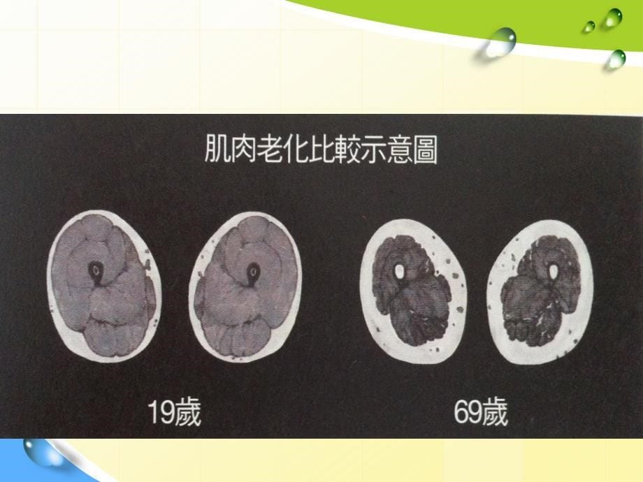 肌少症住院医讲课_第5页