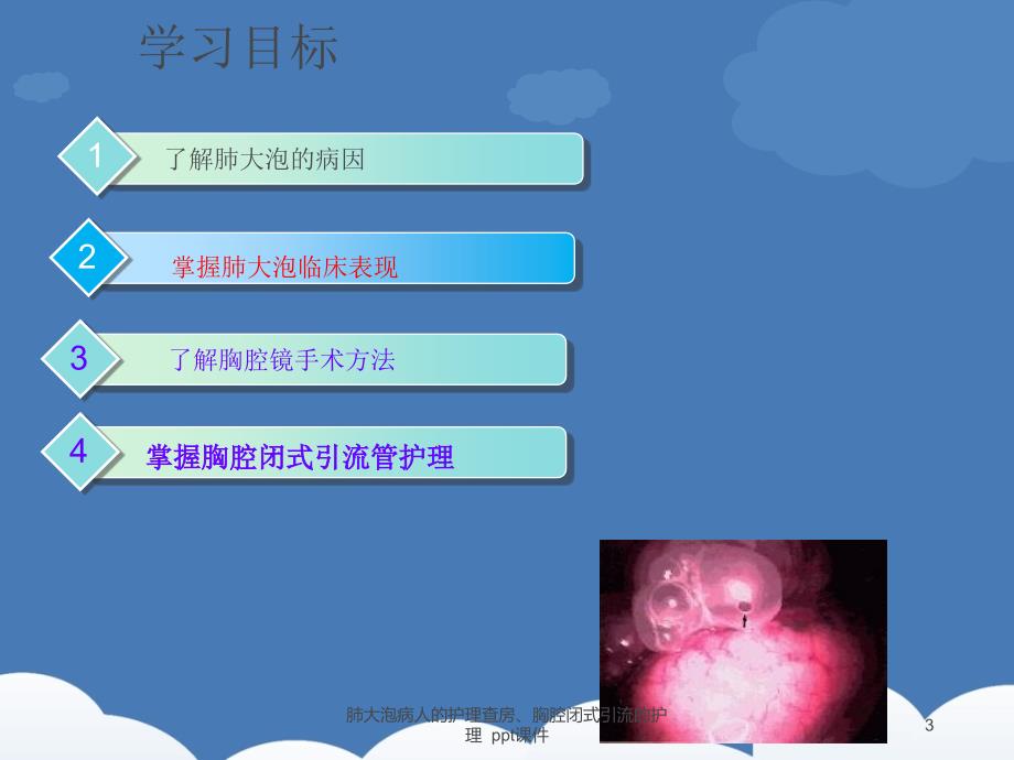 肺大泡病人的护理查房胸腔闭式引流的护理-ppt课课件_第3页