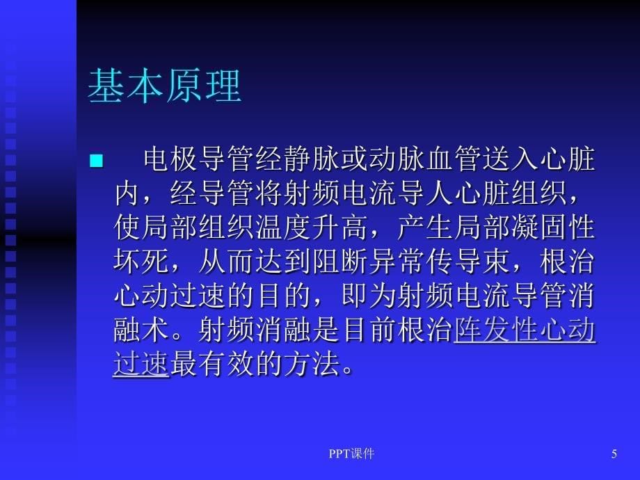 预激综合征与射频消融术课件_第5页