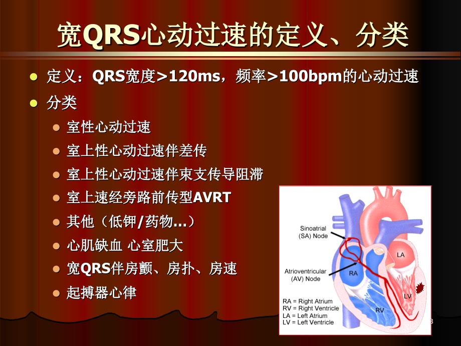 宽QRS心动过速的鉴别诊断_第3页