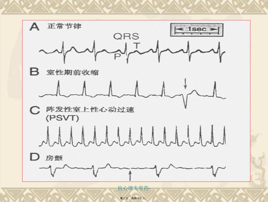 抗心律失常药-课件_第2页