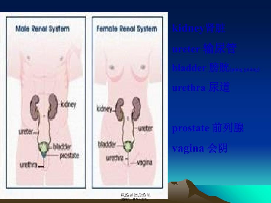 尿路感染最终版课件_第4页