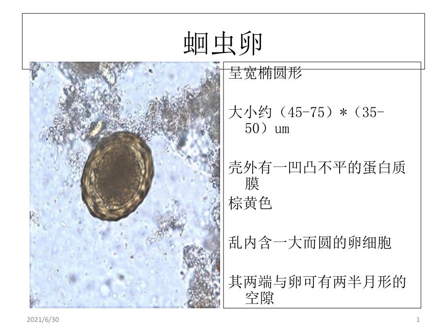 寄生虫学虫卵总结及图片1_第1页