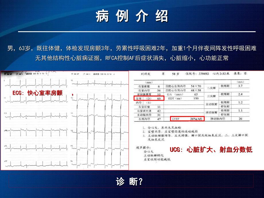 重新认识心律失常性心肌病.ppt_第2页