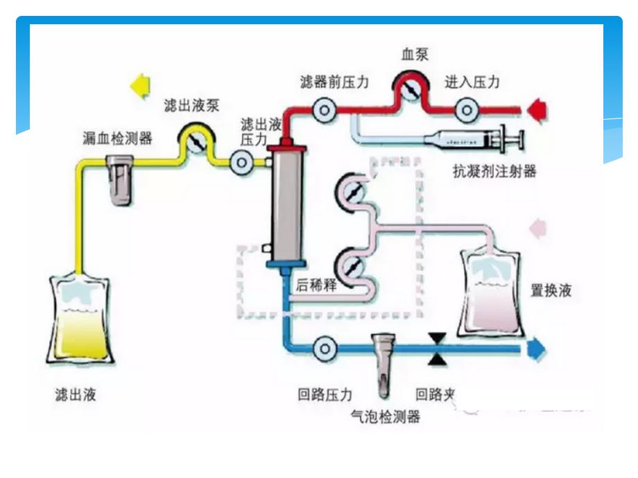 血液透析护理操作过程风险管理_第2页