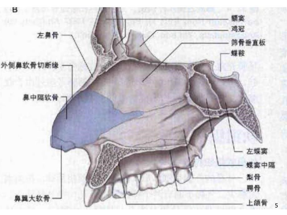 窦口鼻道复合体影像解剖及临床意义ppt课件_第5页