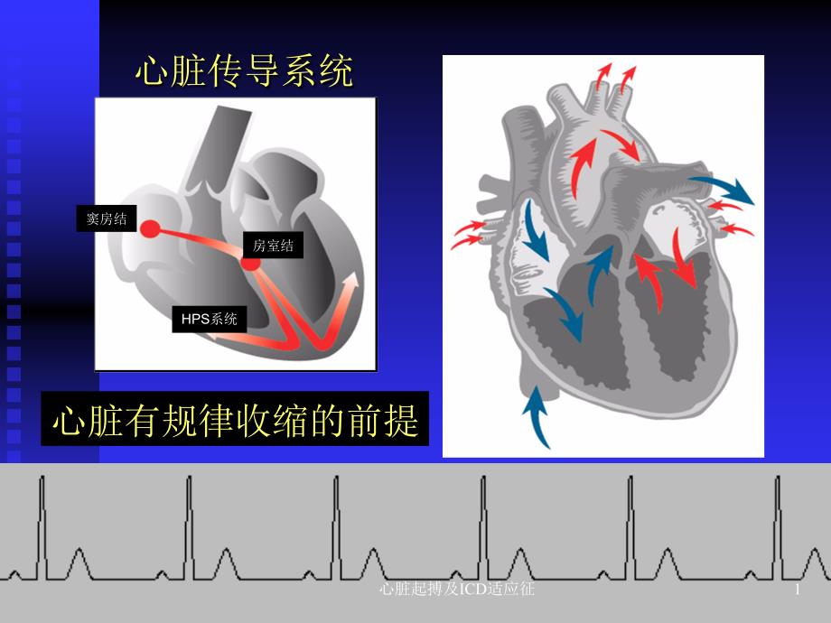 心脏起搏及ICD适应征课件_第1页