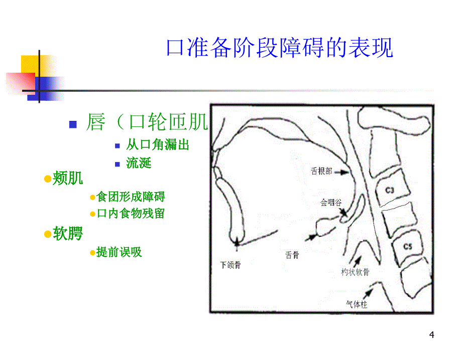 脑卒中后吞咽困难PPT_第4页