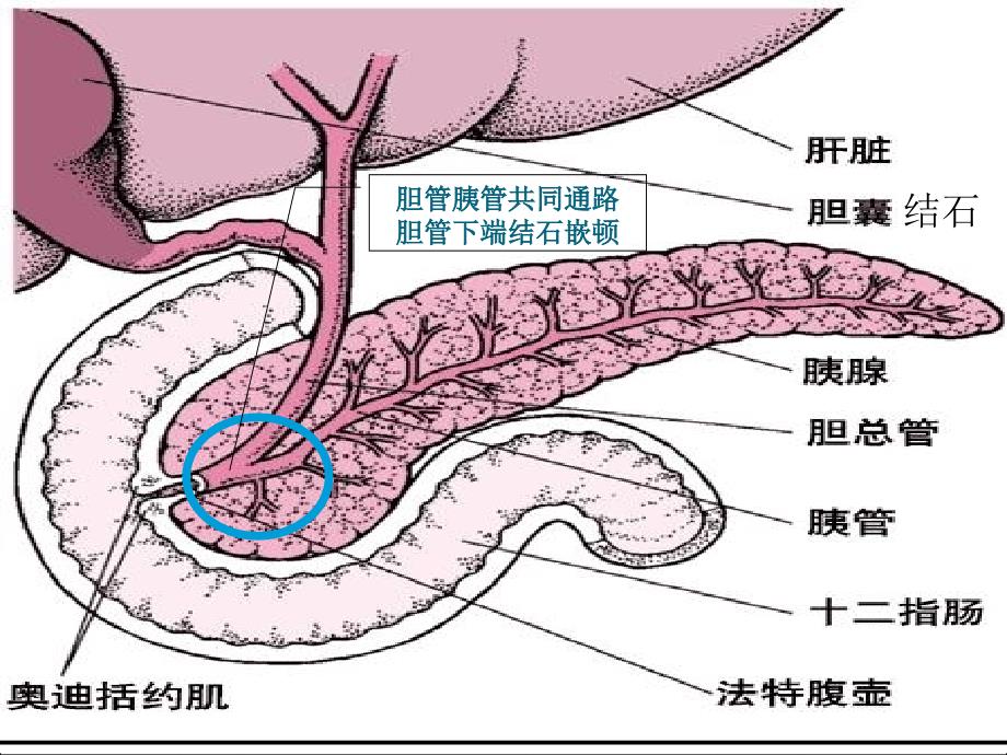 急性重症胰腺炎的护理新进展ppt课件_第3页