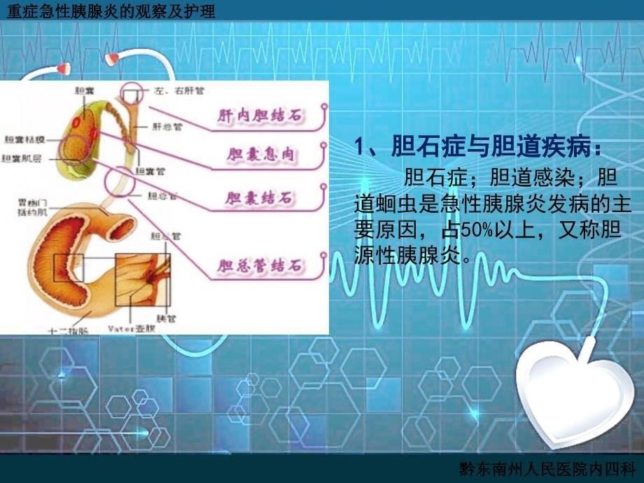 重症急性胰腺炎的观察与护理.ppt_第5页