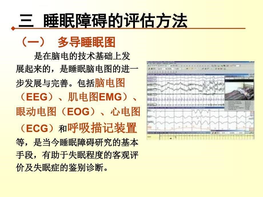 睡眠障碍的康复治疗ppt课件_第5页