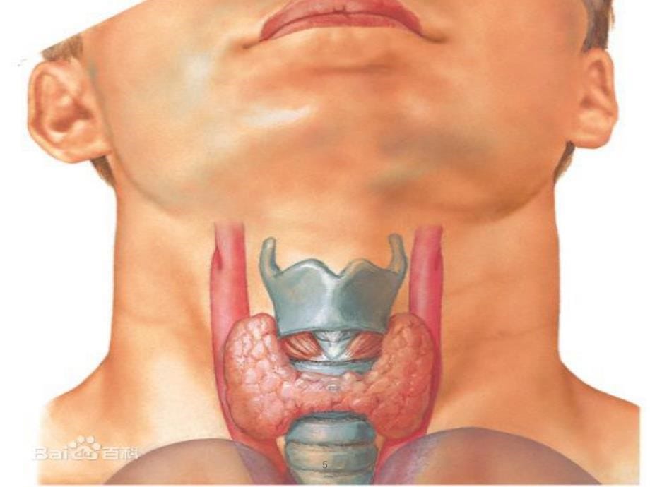 甲状腺大部分切除术.ppt_第5页
