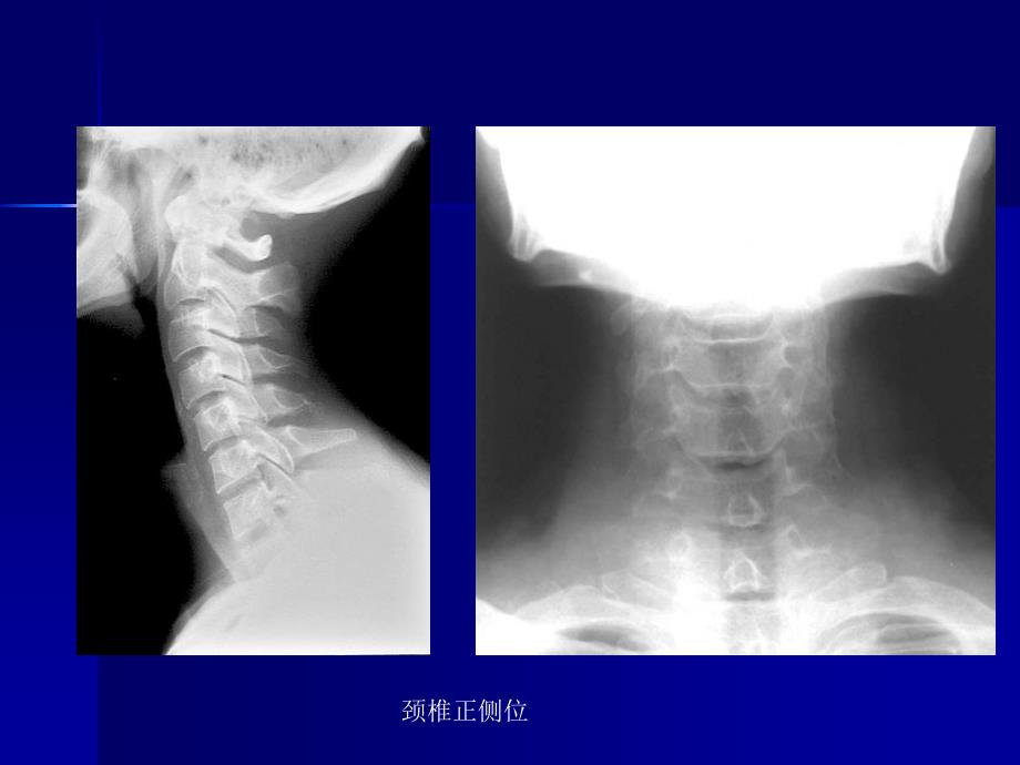 脊柱外科影像学检查_第4页