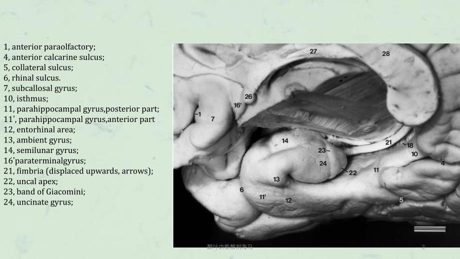 颞叶功能解剖海马课件_第3页