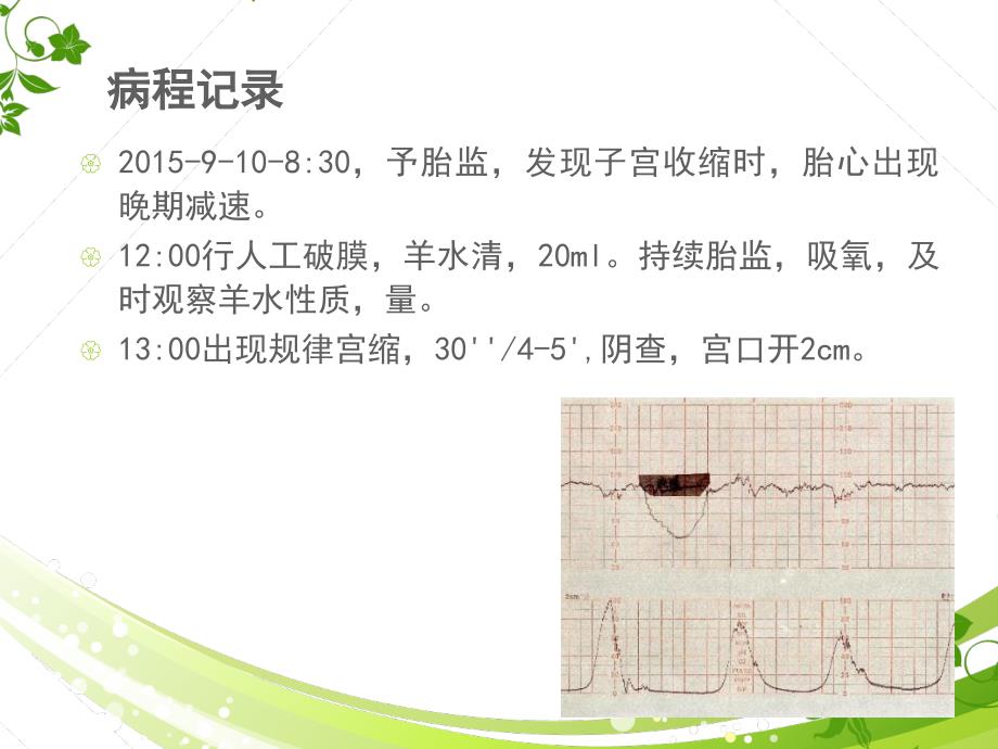 羊水过少护理查房_第4页