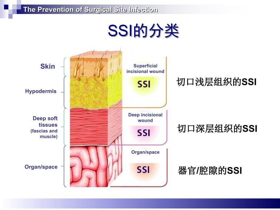 手术部位感染预防与控制新_第5页