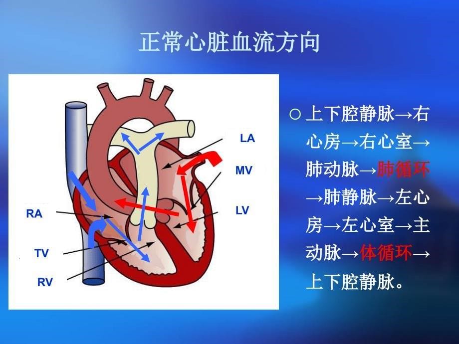 TOF的护理课件.ppt_第5页