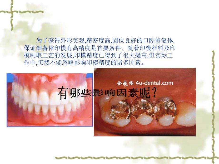 印模精度的影响因素_第2页