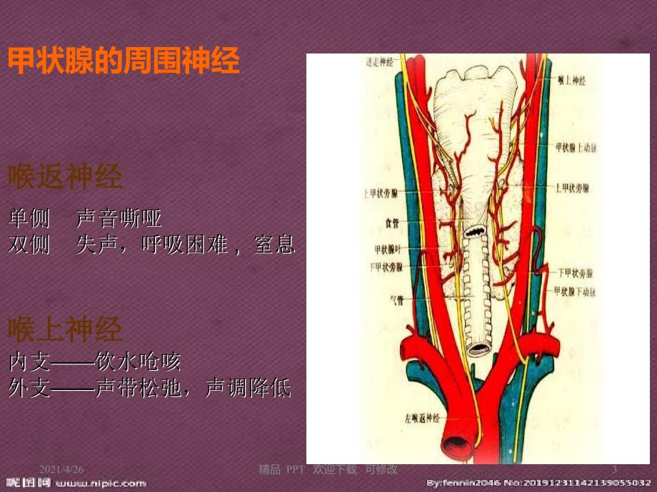 甲状腺肿瘤护理查房教学课件_第3页