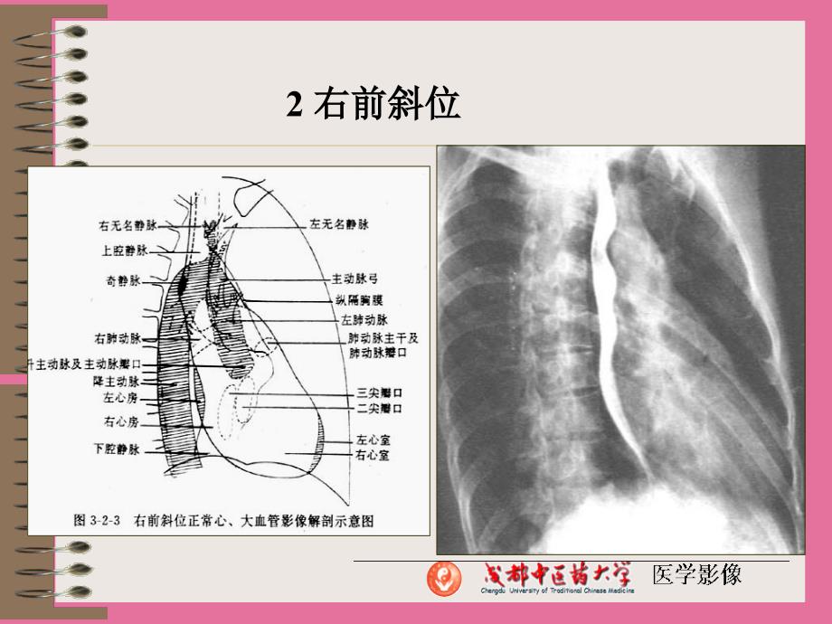 正常解剖及其X线表现ppt课件_第3页