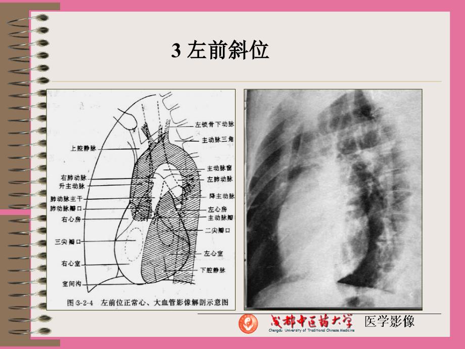 正常解剖及其X线表现ppt课件_第4页