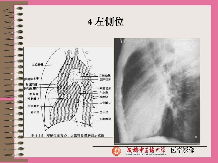 正常解剖及其X线表现ppt课件_第5页