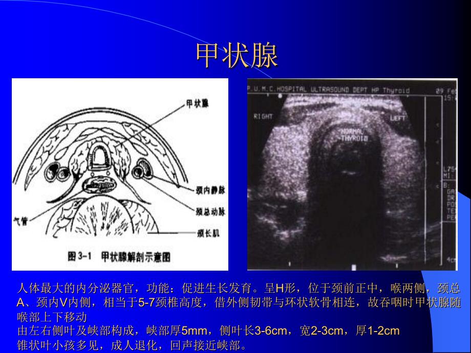 超声医学解剖课件_第4页