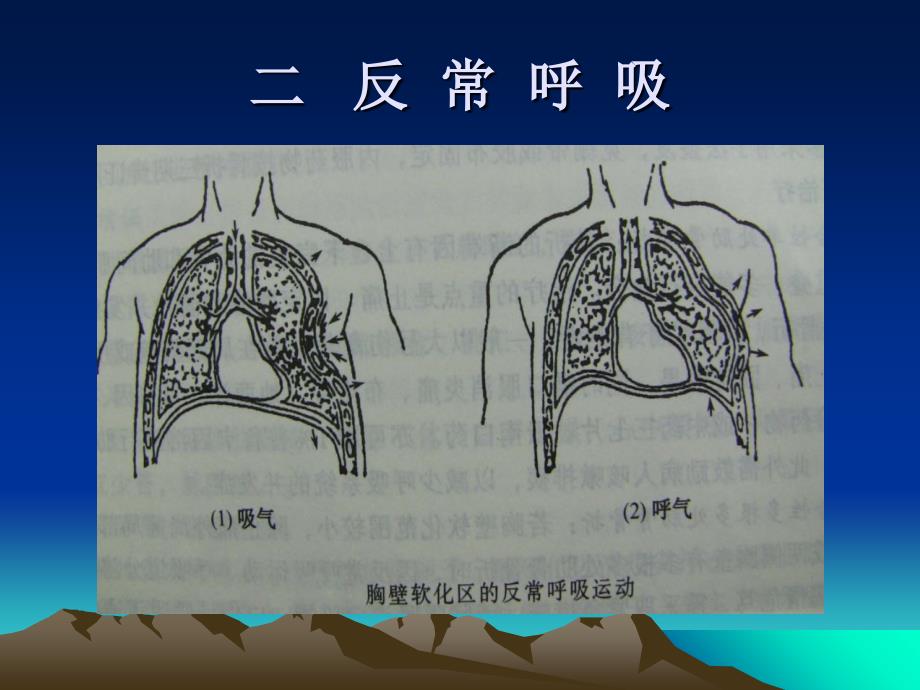 最新：【医药健康】胸部外伤常見紧急情况诊断处理原则文档资料_第4页