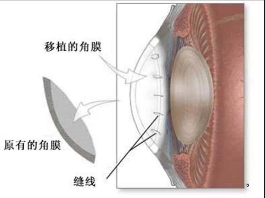 八年级科学下册 3.1 眼和视觉课件 （新版）华东师大版[共35页]_第5页